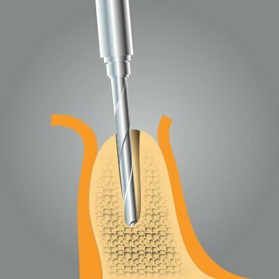 Implantatzentrum Herne