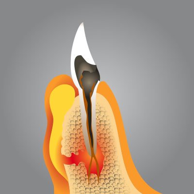 Implantatzentrum Herne