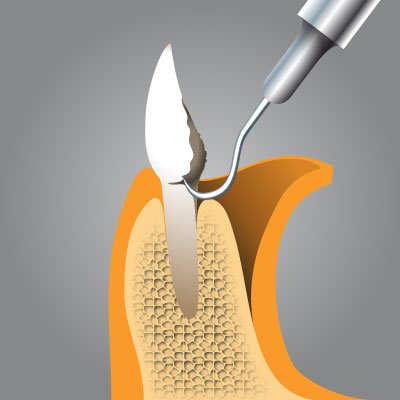 Implantatzentrum Herne