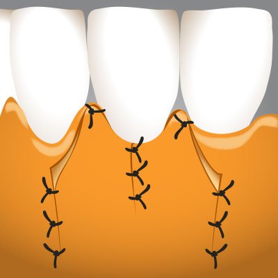 Implantatzentrum Herne