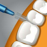 Implantatzentrum Herne