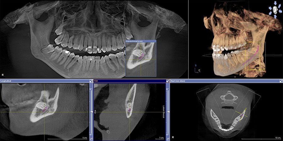 Implantatzentrum Herne