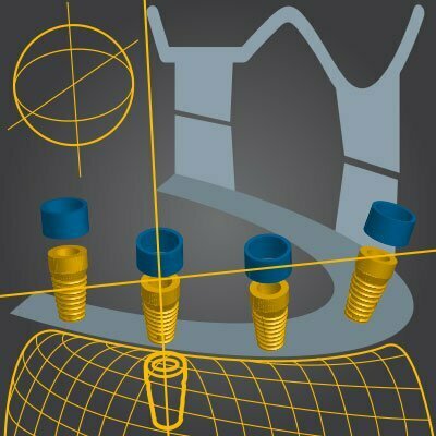 Zahnarzt Herne Minimalinvasive 1 3D Augmentation/Schalentechnik