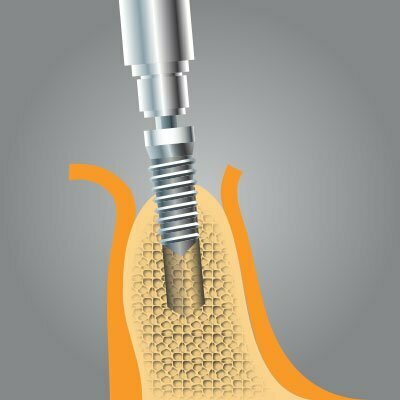 Implantatzentrum Herne